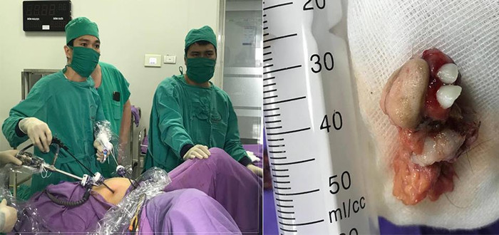 Bệnh viện tuyến tỉnh cứu sống thành công 4 bệnh nhi bị tim bẩm sinh ảnh 2