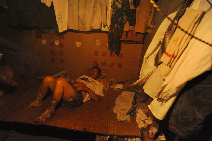 Lở loét chân tay vì tiếp xúc với bụi đá mỗi ngày