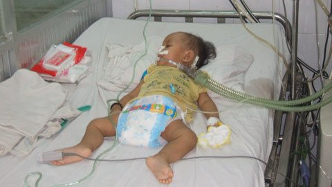 Một bệnh nhi bị TCM đang điều trị tại BV Nhi đồng 1