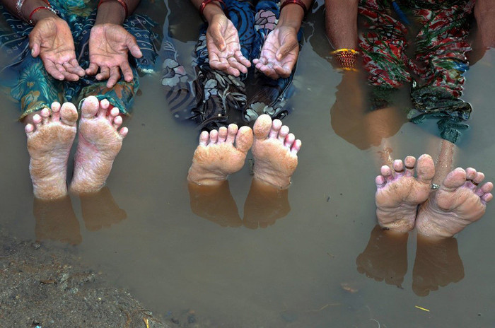 Ngày 4/9, 51 hộ dân bang Madhya Pradesh, Ấn Độ ngâm mình trong nước suốt 14 ngày biểu tình phản đối chính quyền địa phương xả nước đập làm ngập hết ruộng vườn nhà họ Ngày 4/9, 51 hộ dân bang Madhya Pradesh, Ấn Độ ngâm mình trong nước suốt 14 ngày biểu tình phản đối chính quyền địa phương xả nước đập làm ngập hết ruộng vườn nhà họ