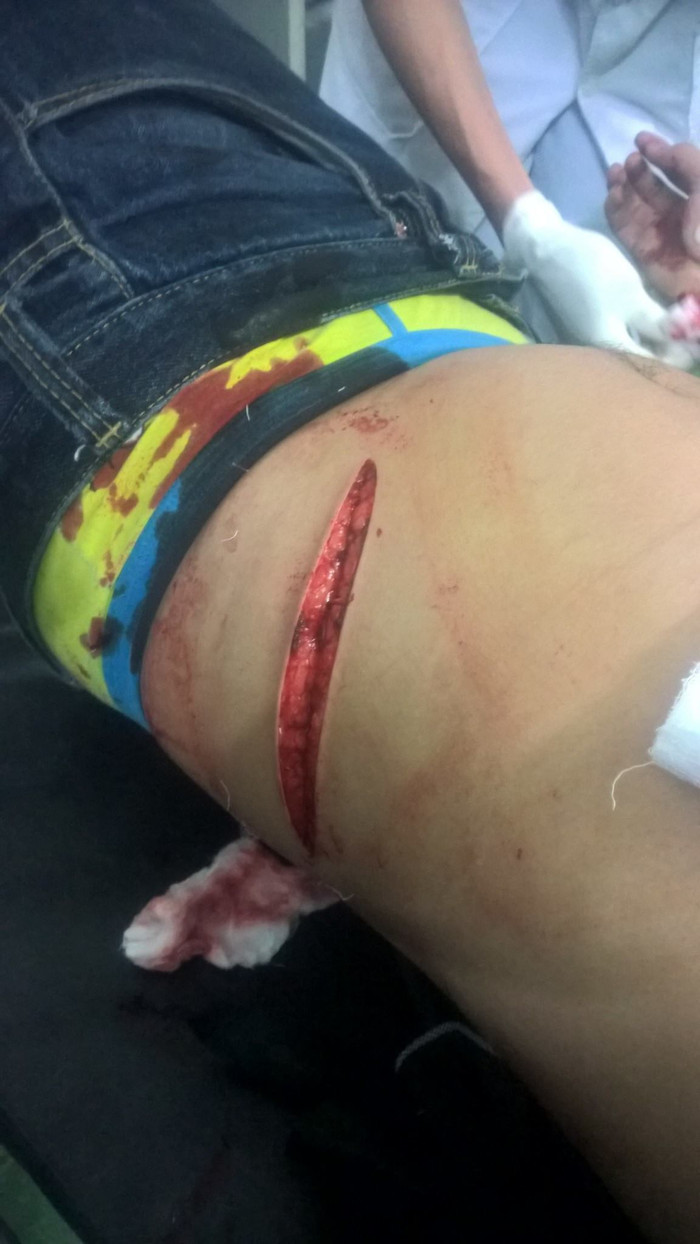 Một phụ xe của nhà xe Khánh Duy bị phụ xe của nhà xe Hoàng Phương hành hung gây thương tích nặng. Một phụ xe của nhà xe Khánh Duy bị phụ xe của nhà xe Hoàng Phương hành hung gây thương tích nặng.