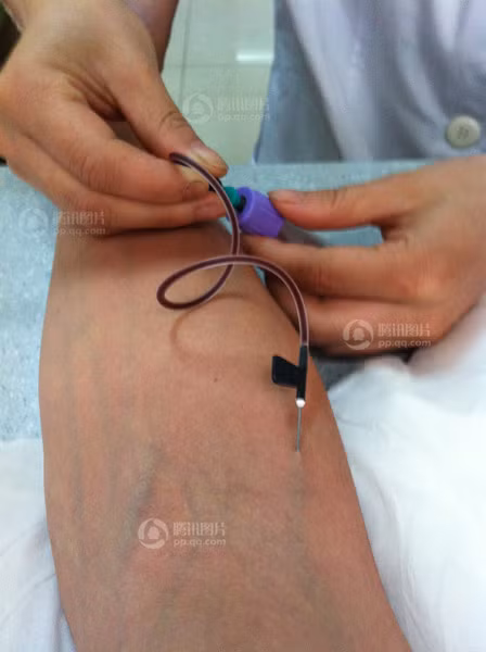 Trước khi bán thận, người bán phải trải qua các thủ tục xét nghiệm các chỉ số máu, nước tiểu, viêm gan, HIV...