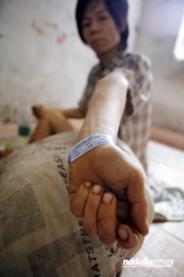 Chìa cánh tay khẳng khiu như que củi vẫn còn dính tem khám bệnh cho phóng viên