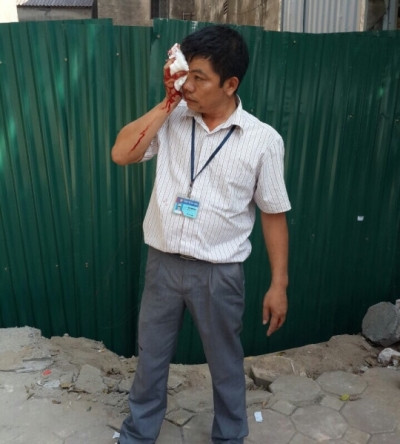 Người nhà của chủ đầu tư cản trở cơ quan chức năng bằng "gạch". Ảnh: tư liệu Người nhà của chủ đầu tư cản trở cơ quan chức năng bằng "gạch". Ảnh: tư liệu