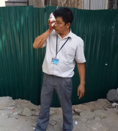 Người nhà của chủ đầu tư cản trở cơ quan chức năng bằng "gạch". Ảnh: tư liệu