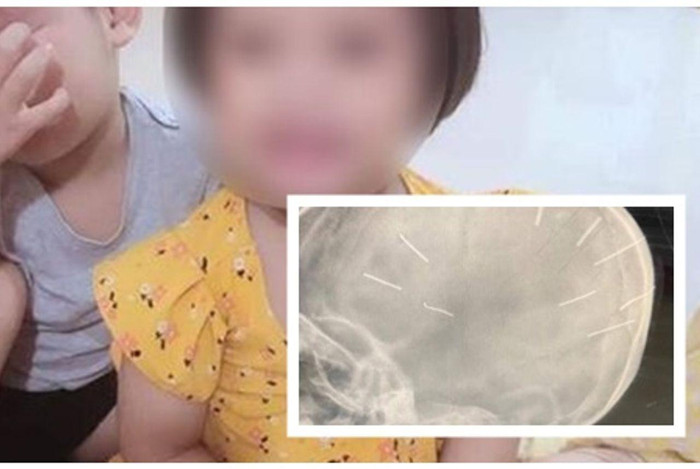 Sự viêc bé Đ.N.A thu hút sự chú ý của xã hội. Ảnh: Giaothong Sự viêc bé Đ.N.A thu hút sự chú ý của xã hội. Ảnh: Giaothong