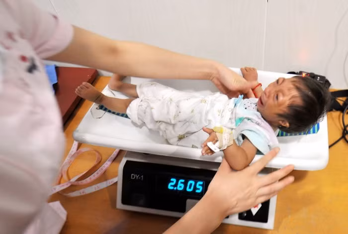Cô bé chỉ nặng 2,6 kg