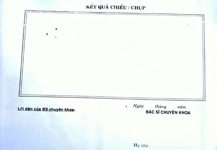 Kết quả chụp X-Quang tại Bệnh viện Chấn thương chỉnh hình thành phố Hồ Chí Minh không thể hiện nữ sinh bị vẹo cột sống. (Ảnh: H.L)