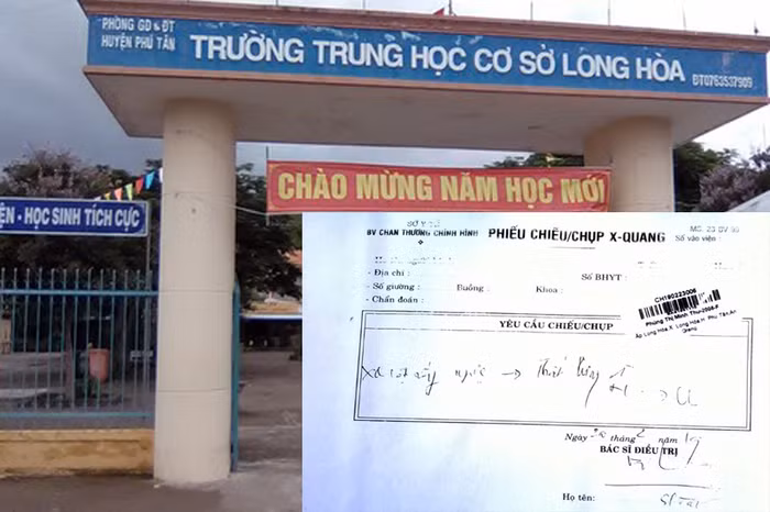 Kỷ luật cảnh cáo thầy giáo đánh học sinh ở An Giang ảnh 2