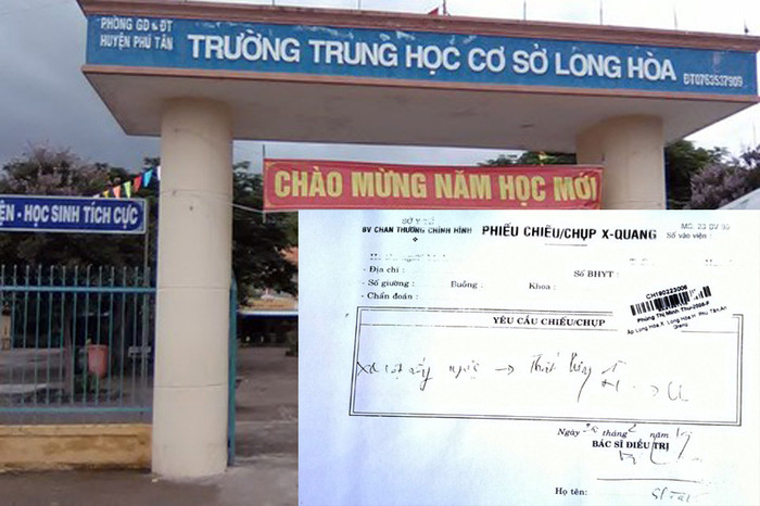 Kỷ luật cảnh cáo thầy giáo đánh học sinh ở An Giang ảnh 2 Kỷ luật cảnh cáo thầy giáo đánh học sinh ở An Giang ảnh 2