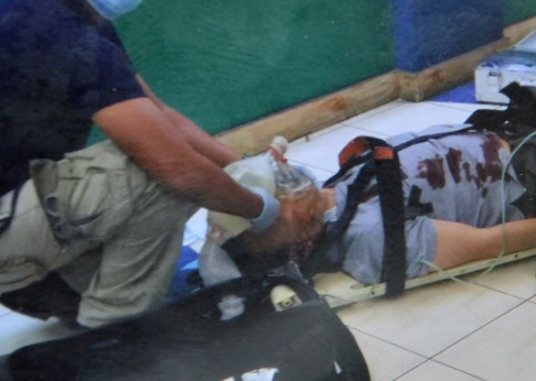 Ông Tổng lãnh sự Trung Quốc bị trúng đạn, nhưng không nguy hiểm đến tính mạng, ảnh: SCMP. Ông Tổng lãnh sự Trung Quốc bị trúng đạn, nhưng không nguy hiểm đến tính mạng, ảnh: SCMP.