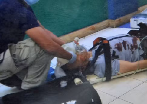 Ông Tổng lãnh sự Trung Quốc bị trúng đạn, nhưng không nguy hiểm đến tính mạng, ảnh: SCMP.