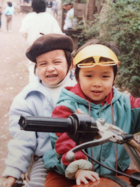 Nam ca sĩ khoe răng sún