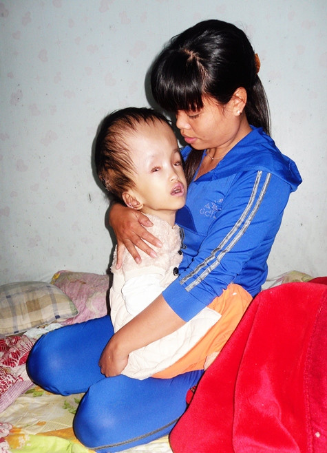 Bé Hồng Ngọc đang duy trì sự sống từng ngày trong nỗ lực tuyệt vọng của người mẹ. Bé Hồng Ngọc đang duy trì sự sống từng ngày trong nỗ lực tuyệt vọng của người mẹ.