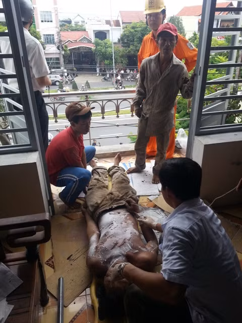 Nạn nhân bị điện giật cháy sém, rất may thoát chết trong gang tấc. Ảnh H.Q