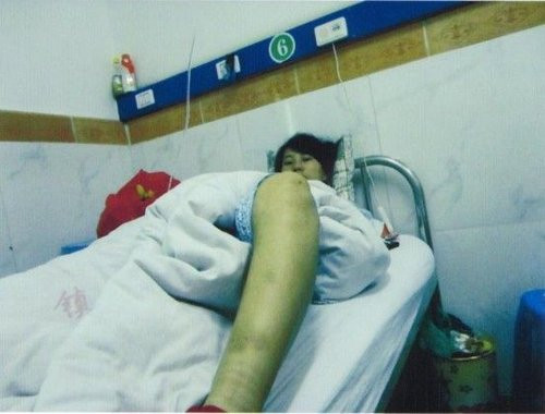 Chị Mai vẫn chưa hết bàng hoàng, sức khỏe và tinh thần đều suy sụp sau vụ cưỡng chế phá thai Chị Mai vẫn chưa hết bàng hoàng, sức khỏe và tinh thần đều suy sụp sau vụ cưỡng chế phá thai