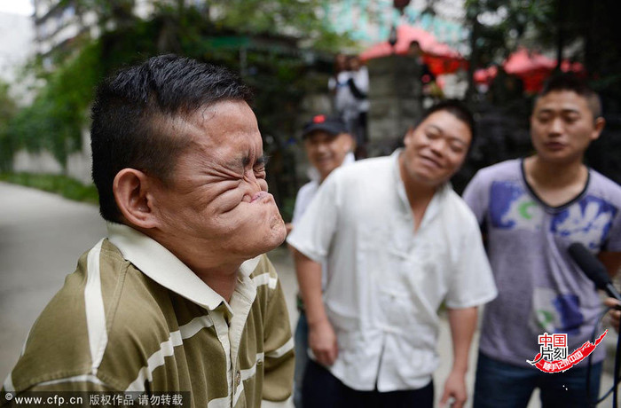 "Quỷ mặt nát" biểu diễn tuyệt kỹ đường phố: Dùng môi dưới che kín mũi khiến khuôn mặt biến dạng hoàn toàn "Quỷ mặt nát" biểu diễn tuyệt kỹ đường phố: Dùng môi dưới che kín mũi khiến khuôn mặt biến dạng hoàn toàn