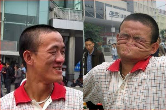 Khuôn mặt bình thường và "mặt quỷ", mặt nát Khuôn mặt bình thường và "mặt quỷ", mặt nát