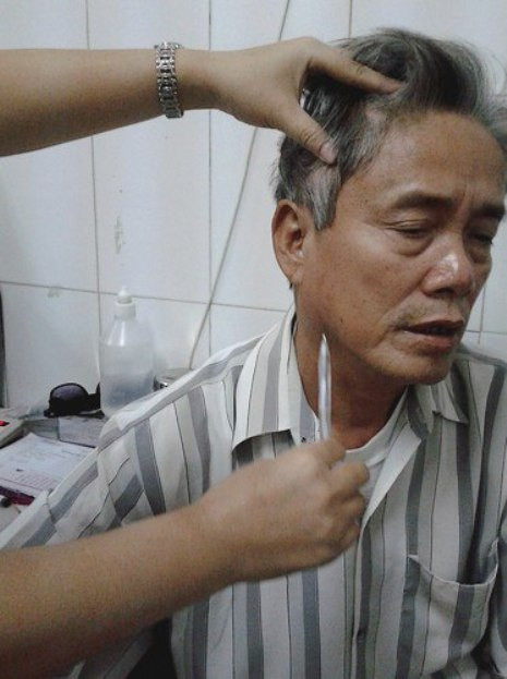 Bệnh zona thần kinh do virus với đặc trưng là các bọng nước nổi thành từng đám, bệnh nhân thấy đau. Bệnh zona thần kinh do virus với đặc trưng là các bọng nước nổi thành từng đám, bệnh nhân thấy đau.