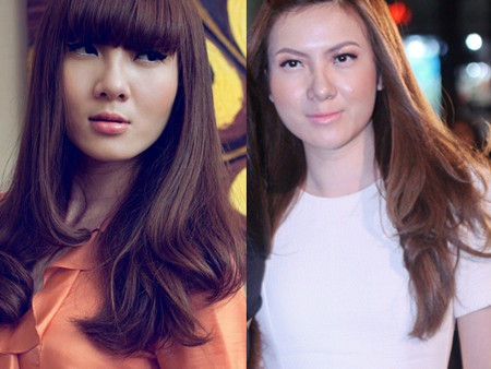 Khuôn mặt sưng phù vì bottox của Yến Nhi sau phẫu thuật