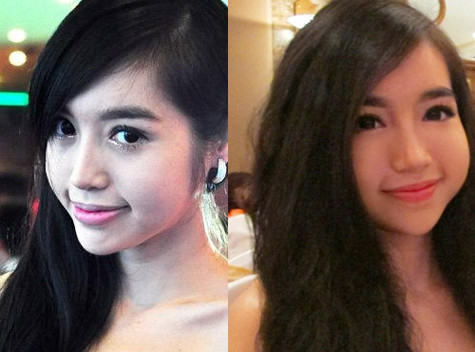 Hot girl nóng bỏng Elly Trần từng nhiến nhiều người "giật mình" vì 2 bên má phình ra như 2 chiếc bánh bao. Nhiều người nghi ngờ, khuôn mặt sưng vù của cô là do sự phụ thuộc vào thuốc tiêm botox căng da mặt.