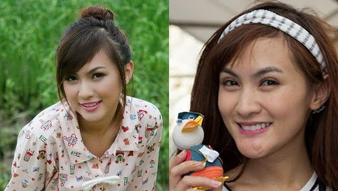 Hình ảnh cho thấy sự khác biệt của Kelly trước và sau khi nhờ "dao kéo" can thiệp.