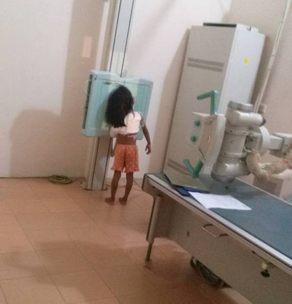 Cháu H. chụp phim tại bệnh viện (Ảnh do gia đình cháu H. chụp lại) Cháu H. chụp phim tại bệnh viện (Ảnh do gia đình cháu H. chụp lại)