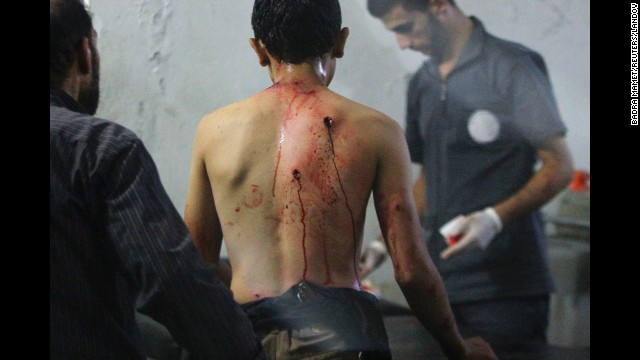 Nạn nhân của một cuộc giao tranh tại Kobani, Syria.