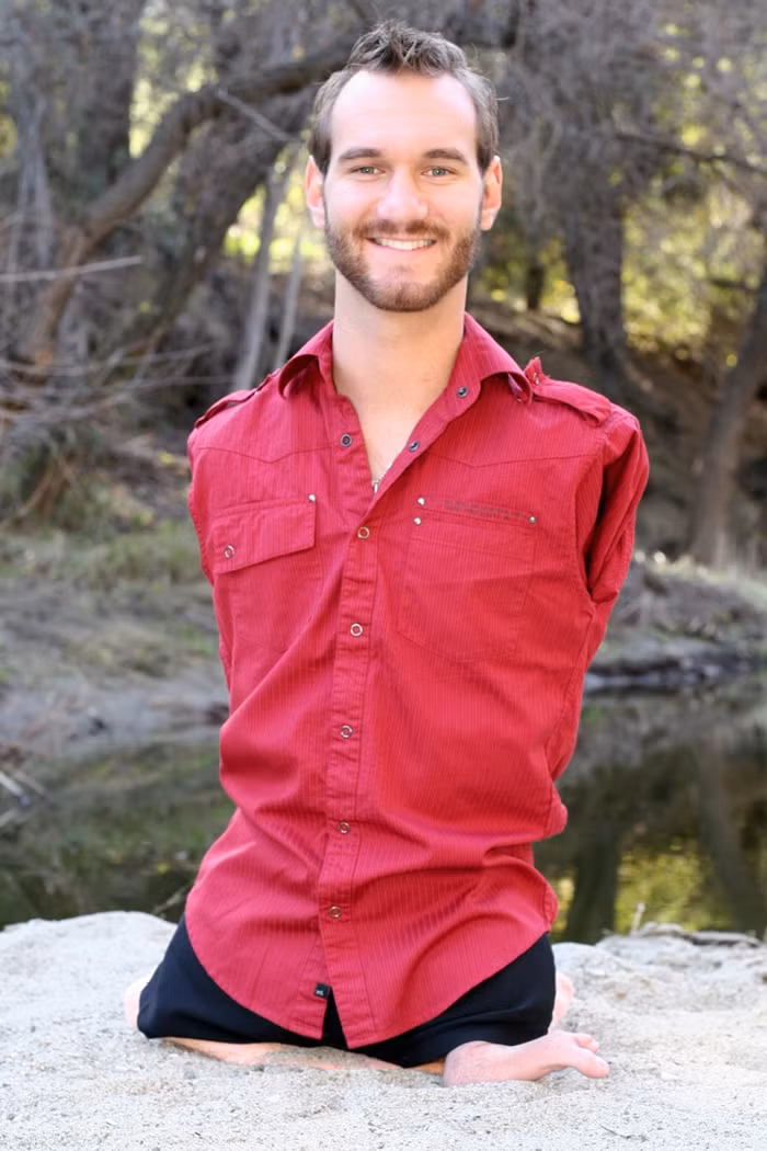 Nick Vujicic đã vươn lên trở thành biểu tượng của ý chí, nghị lực con người, trở thành diễn giả nổi tiếng thế giới với những chủ đề liên quan tới niềm tin yêu cuộc sống.