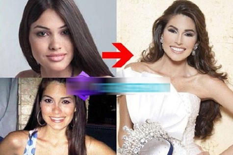 Gabriela Isler dính nghi án "dao kéo"