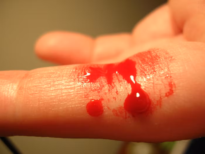 Chơi dao sắc có ngày đứt tay, huống hồ lại là con dao hai lưỡi. Ảnh minh họa: Wikipedia.