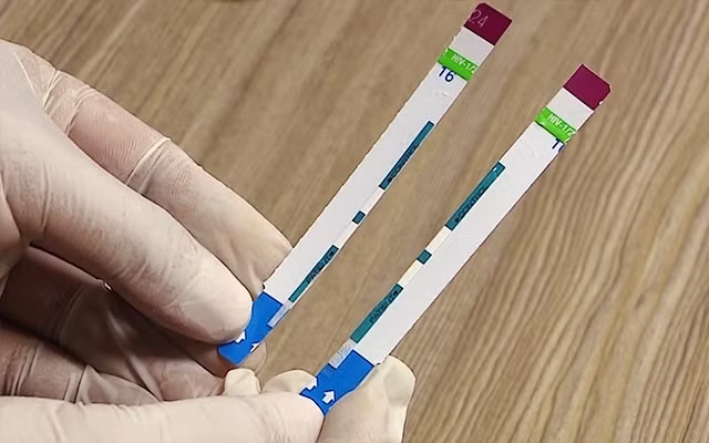 Vụ việc cắt đôi que thử nghiệm từng bị phát hiện tại bệnh viện Xanh pôn.