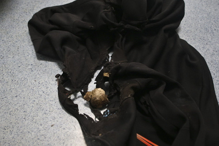 Cháy quần áo vì xem pháo hoa Cháy quần áo vì xem pháo hoa