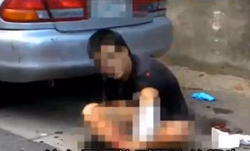 Sài Văn, một học sinh 15 tuổi đi theo "bênh bạn" bị chém 2 nhát