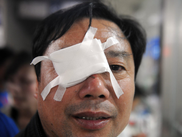 Pháo hoa nhằm trúng mắt người đàn ông này Pháo hoa nhằm trúng mắt người đàn ông này