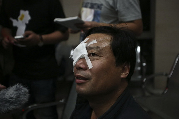 Nguy hiểm khi pháo hoa bắn vào mắt Nguy hiểm khi pháo hoa bắn vào mắt