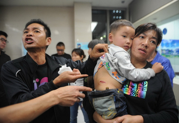 Phẫn nộ vì con mình bị bỏng bởi pháo hoa Phẫn nộ vì con mình bị bỏng bởi pháo hoa