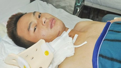 Xuân Hiếu bị tai nạn giao thông khi đang đi bộ trên đường. Xuân Hiếu bị tai nạn giao thông khi đang đi bộ trên đường.