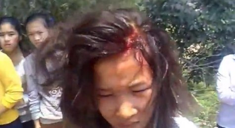 Hai nữ sinh đánh nhau đến... chảy máu đầu CHÙM ẢNH: NHỮNG TRÒ QUÁI CHIÊU CỦA SINH VIÊN TRUNG QUỐC NHỮNG TRÒ ĐÙA QUÁI ĐẢN CHỈ CÓ HỌC SINH MỚI NGHĨ RA Hai nữ sinh đánh nhau đến... chảy máu đầu CHÙM ẢNH: NHỮNG TRÒ QUÁI CHIÊU CỦA SINH VIÊN TRUNG QUỐC NHỮNG TRÒ ĐÙA QUÁI ĐẢN CHỈ CÓ HỌC SINH MỚI NGHĨ RA