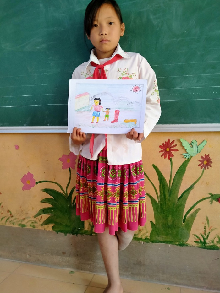Ước mơ đôi chân của cô bé người dân tộc Mông, em hi vọng một ngày nào đó có đủ 2 chân để Sấu đến trường. Ảnh: LC