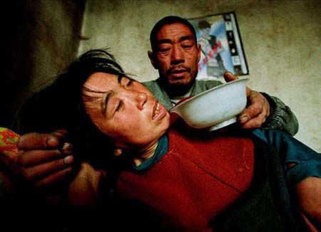 Một bệnh nhân ung thư tại Trung Quốc (hình minh họa) Một bệnh nhân ung thư tại Trung Quốc (hình minh họa)