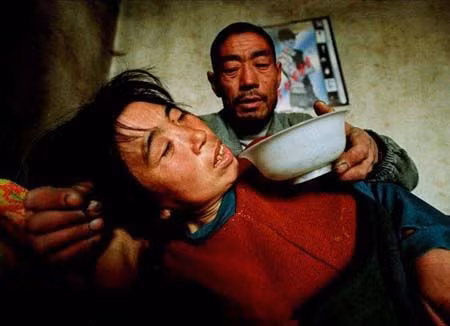 Một bệnh nhân ung thư tại Trung Quốc (hình minh họa)