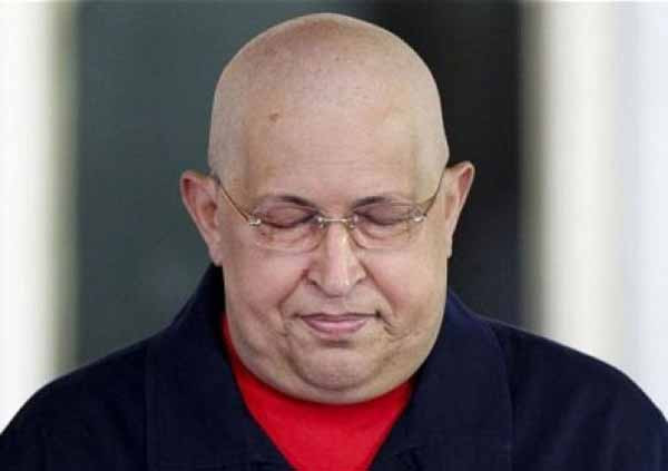 Tổng thống Venezuela Hugo Chavez đang điều trị ung thư Tổng thống Venezuela Hugo Chavez đang điều trị ung thư