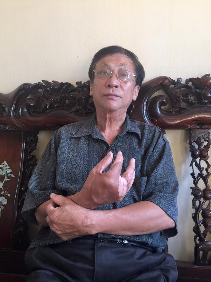 Ông Phạm Văn Luật, Chủ tịch Hội Người mù huyện Phú Xuyên cho rằng: ông Chu Phú Mỹ có nhiều sai phạm khi còn là Chủ tịch UBND huyện Phú Xuyên. Ảnh: Hải Ninh Ông Phạm Văn Luật, Chủ tịch Hội Người mù huyện Phú Xuyên cho rằng: ông Chu Phú Mỹ có nhiều sai phạm khi còn là Chủ tịch UBND huyện Phú Xuyên. Ảnh: Hải Ninh