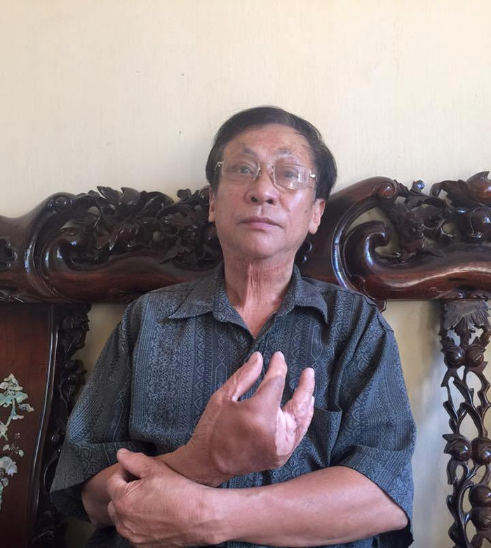 Ông Phạm Văn Luật, Chủ tịch Hội Người mù huyện Phú Xuyên (TP. Hà Nội). Ảnh Hải Ninh Ông Phạm Văn Luật, Chủ tịch Hội Người mù huyện Phú Xuyên (TP. Hà Nội). Ảnh Hải Ninh