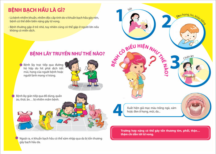 Thông tin về bệnh Bạch hầu của Sở Y tế An Giang. Thông tin về bệnh Bạch hầu của Sở Y tế An Giang.