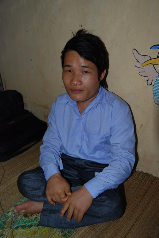 Em Phạm Văn Quyết chỉ cao 1,1 mét với đôi bàn chân bị teo quắt, qua nhiều lần phẫu thuật mới có thể đi lại được (Ảnh: Đỗ Quyên) Em Phạm Văn Quyết chỉ cao 1,1 mét với đôi bàn chân bị teo quắt, qua nhiều lần phẫu thuật mới có thể đi lại được (Ảnh: Đỗ Quyên)