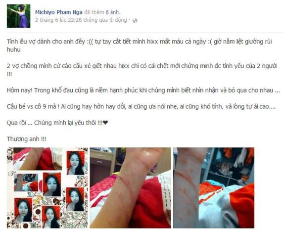 Những vết cứa trên tay thể hiện tình yêu của Michiyo Phạm Ngà