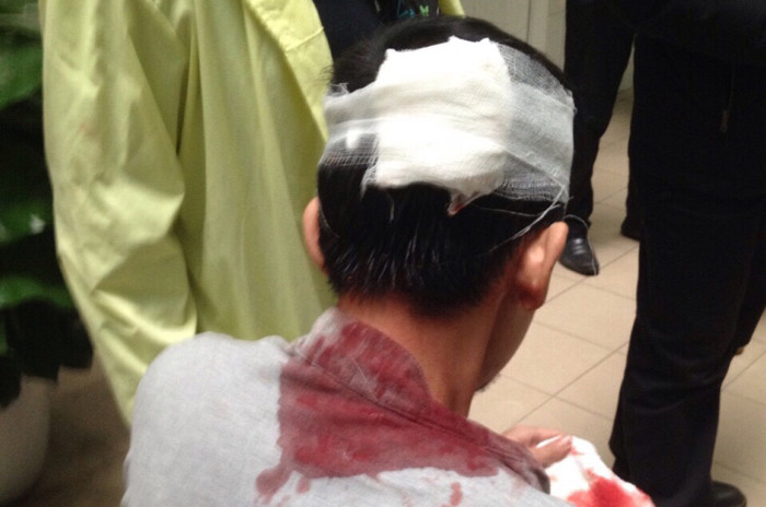 Anh Linh bị đập vào đầu mất khá nhiều máu