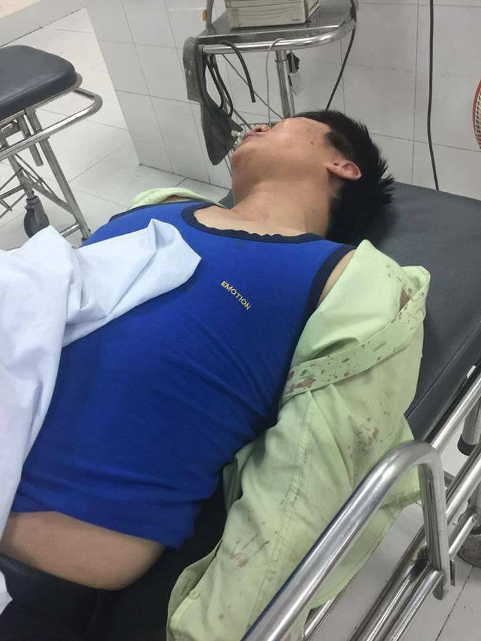 Anh Lưu Ngọc Tân (SN 1981, trú tại phòng 504, N6B, Trung Hoà – Nhân Chính, Thanh Xuân, Hà Nội) bị hành hung trong cuộc nhậu có mặt của các sếp Sở xây dựng tỉnh Vĩnh Phúc. Ảnh Congluan.vn Anh Lưu Ngọc Tân (SN 1981, trú tại phòng 504, N6B, Trung Hoà – Nhân Chính, Thanh Xuân, Hà Nội) bị hành hung trong cuộc nhậu có mặt của các sếp Sở xây dựng tỉnh Vĩnh Phúc. Ảnh Congluan.vn